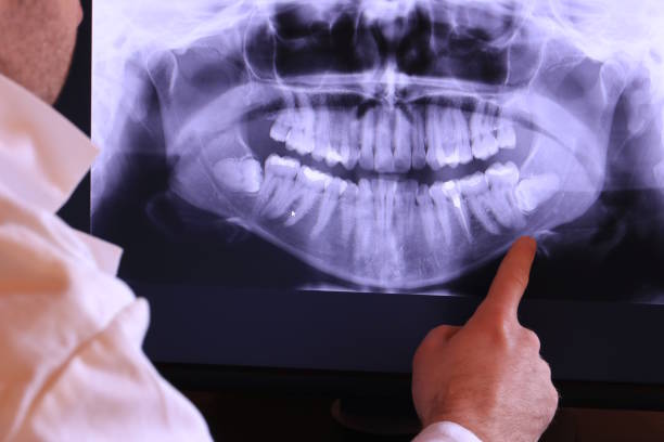 Best Emergency Treatment for Dental Infections or Abscesses in Taft, FL